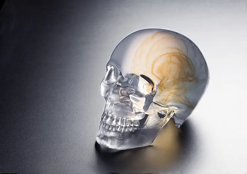 /uploads/image/2023/01/05/Orthopedics_Skull Model 1a 2.jpg.webp Orthopedics_Skull Model 1a 2.jpg.webp